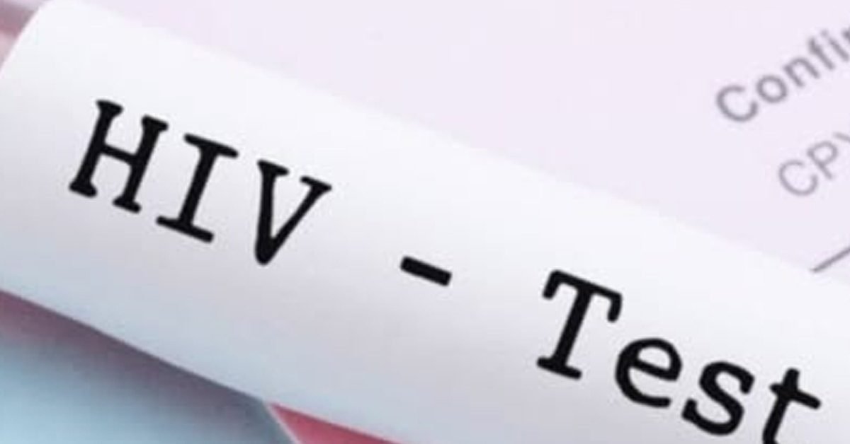 hiv
